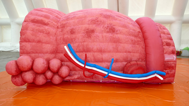 Prostate gonflable géante