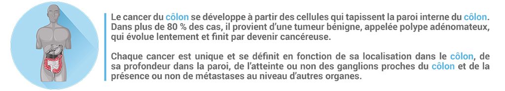 Bandeau explicatif du cancer du colon et de sa localisation dans l'abdomen.