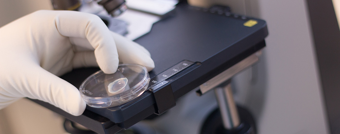 Une cornée est examinée au microscope à la banque de cornée du CHU de Rouen.