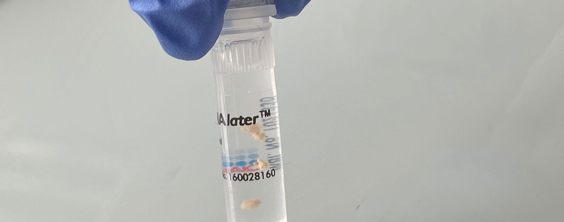 prélèvement-RNA-later-tumothèque CRB-TMT