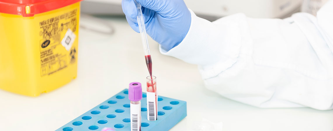 tumorothèque prélèvement-sang-laboratoire CRB
