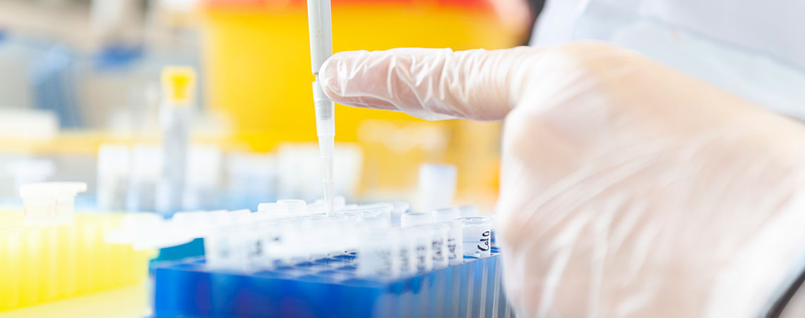 Analyse de prélèvements au laboratoire de biochimie métabolique
